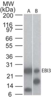 Western Blot: EBI3 Antibody (5P6G8) [NBP2-03942]