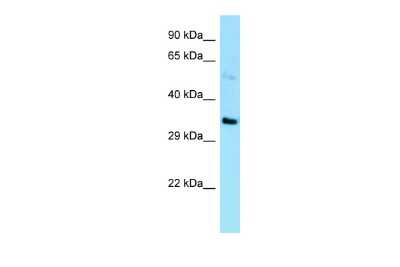 Western Blot: EBNA1BP2 Antibody [NBP2-82965]