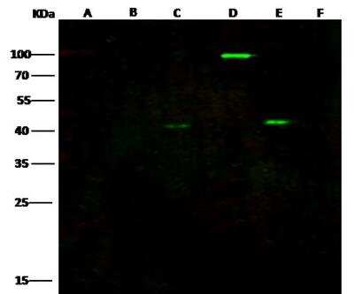 Western Blot: EBOV VP40 protein Antibody [NBP3-12760]