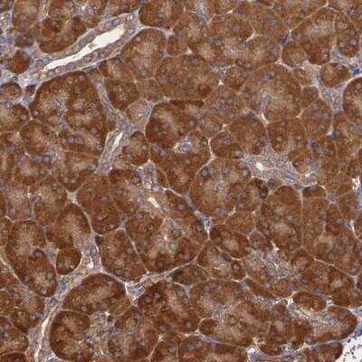 Immunohistochemistry-Paraffin: ECE-1 Antibody [NBP1-84017]