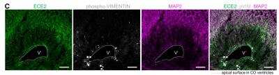 Immunohistochemistry: ECE-2 Antibody [NBP1-81495]