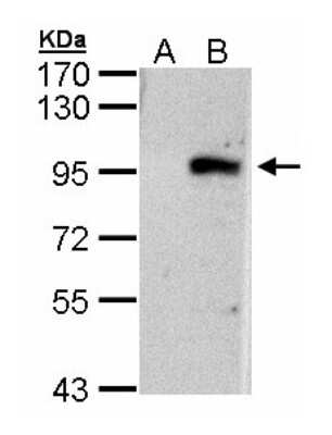 Western Blot: ECEL1 Antibody [NBP2-14938]