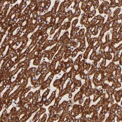 Immunohistochemistry-Paraffin: ECH1 Antibody [NBP1-83216]