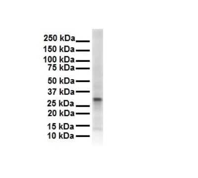 Western Blot: ECHDC2 Antibody [NBP1-79297]