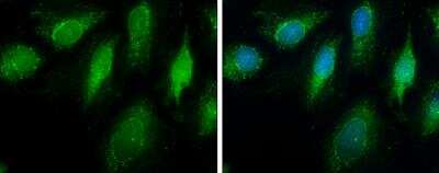 Immunocytochemistry/ Immunofluorescence: ECHS1 Antibody [NBP2-16263]