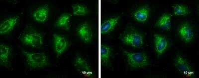 Immunocytochemistry/ Immunofluorescence: ECHS1 Antibody [NBP2-16264]