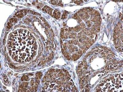 Immunohistochemistry-Paraffin: ECHS1 Antibody [NBP2-16263]