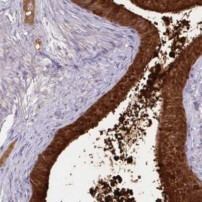 Immunohistochemistry-Paraffin: ECM-1/Secretory Component P85 Antibody [NBP1-87449]