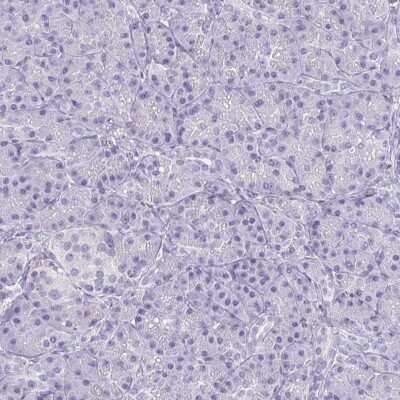 Immunohistochemistry-Paraffin: ECM-1/Secretory Component P85 Antibody [NBP1-87449]