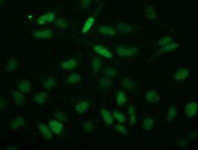 Immunocytochemistry/ Immunofluorescence: ECRG4 Antibody (OTI3B10) [NBP2-00599]