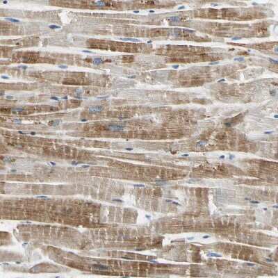 Immunohistochemistry-Paraffin: ECRG4 Antibody [NBP1-84911]