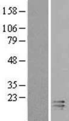 Western Blot: ECRG4 Overexpression Lysate [NBL1-08412]