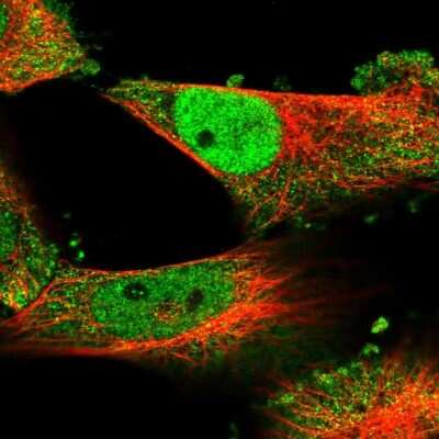 Immunocytochemistry/ Immunofluorescence: ECSIT Antibody [NBP1-91858]