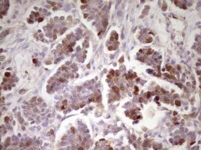 Immunohistochemistry: ECT2 Antibody (OTI2D9) [NBP2-46483]