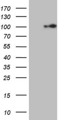 Western Blot: ECT2 Antibody (OTI2D9) [NBP2-46483]