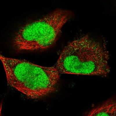 Immunocytochemistry/ Immunofluorescence: ECT2 Antibody [NBP2-58392]