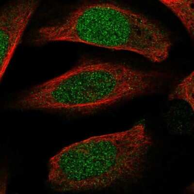 Immunocytochemistry/ Immunofluorescence: ECT2 Antibody [NBP2-68630]