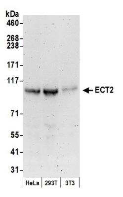 Western Blot: ECT2 Antibody [NBP1-28729]
