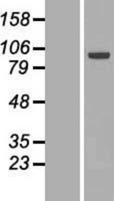 Western Blot: ECT2 Overexpression Lysate [NBL1-10103]