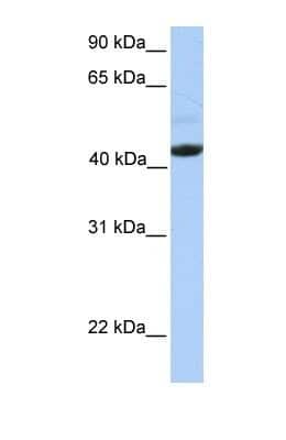 Western Blot: EDAR Antibody [NBP1-69709]
