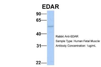 Western Blot: EDAR Antibody [NBP1-69709]