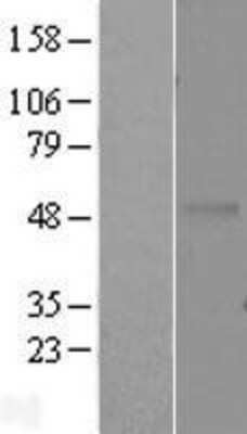 Western Blot: EDAR Overexpression Lysate [NBL1-10105]