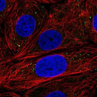 Immunocytochemistry/ Immunofluorescence: EDC3 Antibody [NBP2-57115]