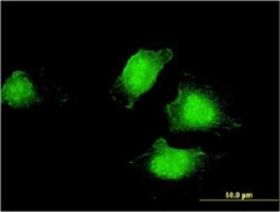 Immunocytochemistry/ Immunofluorescence: EDC4 Antibody (2E2) [H00023644-M01]