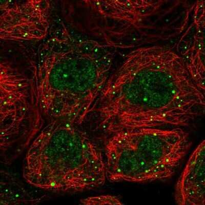Immunocytochemistry/ Immunofluorescence: EDC4 Antibody [NBP2-13944]