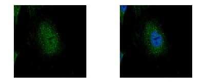 Immunocytochemistry/ Immunofluorescence: EDC4 Antibody [NBP2-16267]