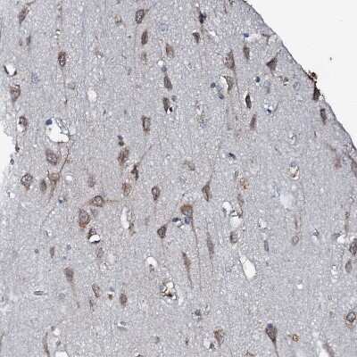 Immunohistochemistry-Paraffin: EDC4 Antibody [NBP2-13944]