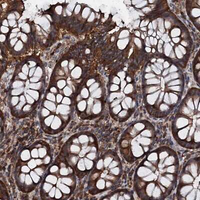 Immunohistochemistry-Paraffin: EDC4 Antibody [NBP2-13944]