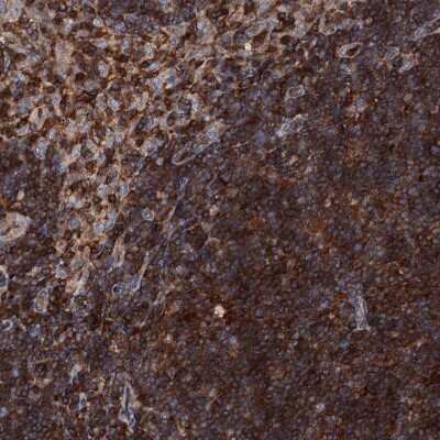 Immunohistochemistry-Paraffin: EDC4 Antibody [NBP2-13944]