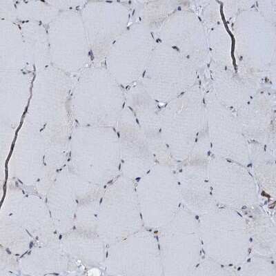 Immunohistochemistry-Paraffin: EDC4 Antibody [NBP2-13944]