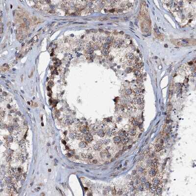 Immunohistochemistry-Paraffin: EDC4 Antibody [NBP2-13944]