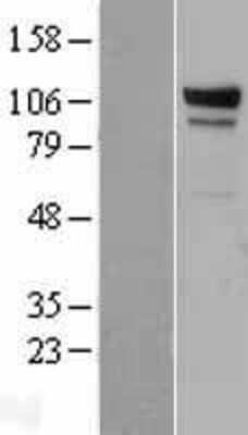 Western Blot: EDEM3 Overexpression Lysate [NBL1-10110]