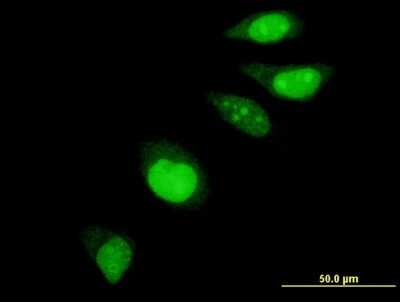 Immunocytochemistry/ Immunofluorescence: EDF1 Antibody (3E6) [H00008721-M03]