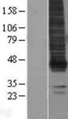 Western Blot: LPAR1/LPA1/EDG-2 Overexpression Lysate [NBL1-12643]