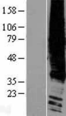 Western Blot: LPAR1/LPA1/EDG-2 Overexpression Lysate [NBP2-05802]