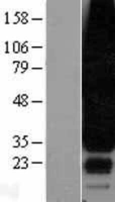 Western Blot: S1P3/EDG-3 Overexpression Lysate [NBL1-15667]