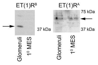 Western Blot: EDNRA/Endothelin R Type A Antibody [NB600-836]