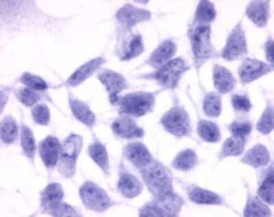 Immunocytochemistry/ Immunofluorescence: EDNRB/Endothelin R Type B Antibody - BSA Free [NLS54]