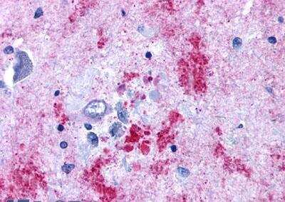 Immunohistochemistry-Paraffin: EDNRB/Endothelin R Type B Antibody - BSA Free [NLS54]