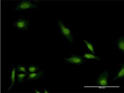 Immunocytochemistry/ Immunofluorescence: EEA1 Antibody (2G2) [H00008411-M03]