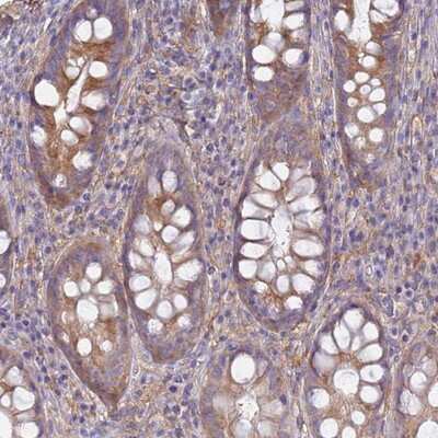 Immunohistochemistry-Paraffin: EEA1 Antibody [NBP1-91859]