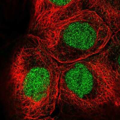 Immunocytochemistry/ Immunofluorescence: EED Antibody [NBP2-57195]