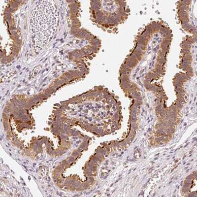 Immunohistochemistry-Paraffin: EEF1A2 Antibody [NBP2-33280]