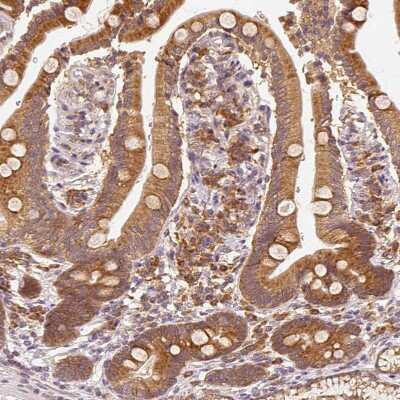 Immunohistochemistry-Paraffin: EEF1A2 Antibody [NBP2-33280]