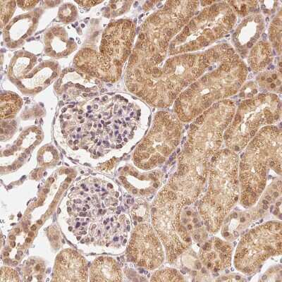 Immunohistochemistry-Paraffin: EEF1A2 Antibody [NBP2-33280]