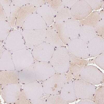Immunohistochemistry-Paraffin: EEF1A2 Antibody [NBP2-33280]